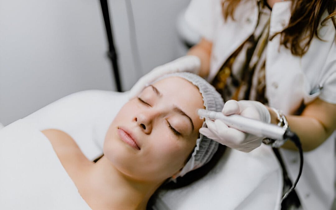 Microneedling for New Patients: What to Expect
