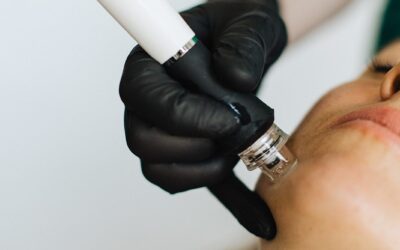 Revitalize Your Skin with the Magic of Microneedling