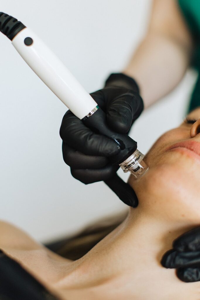 A woman receives medical microneedling.