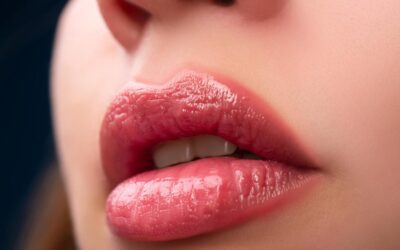 Easy Natural Looking Lip Fillers