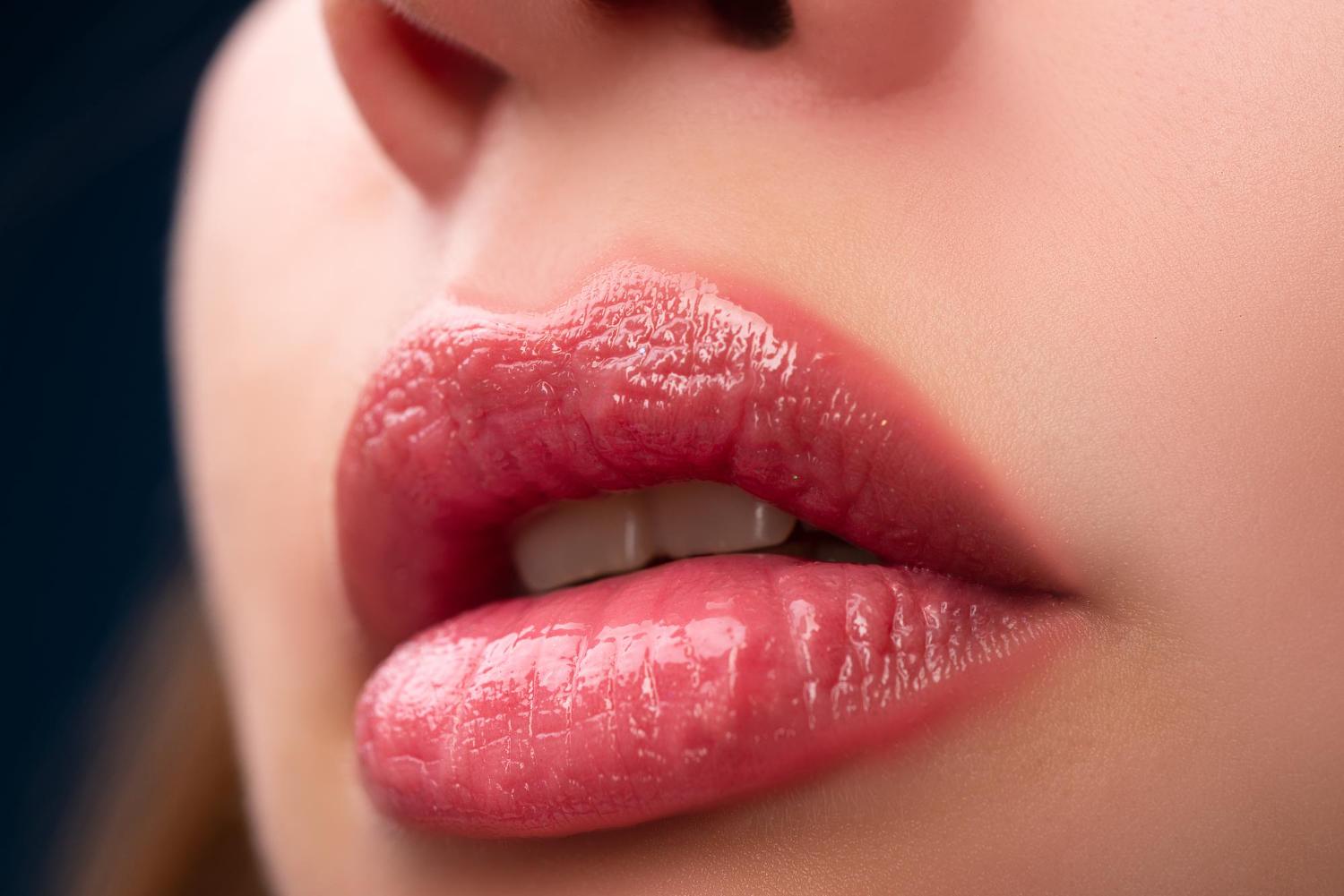 beautiful lips with lip filler