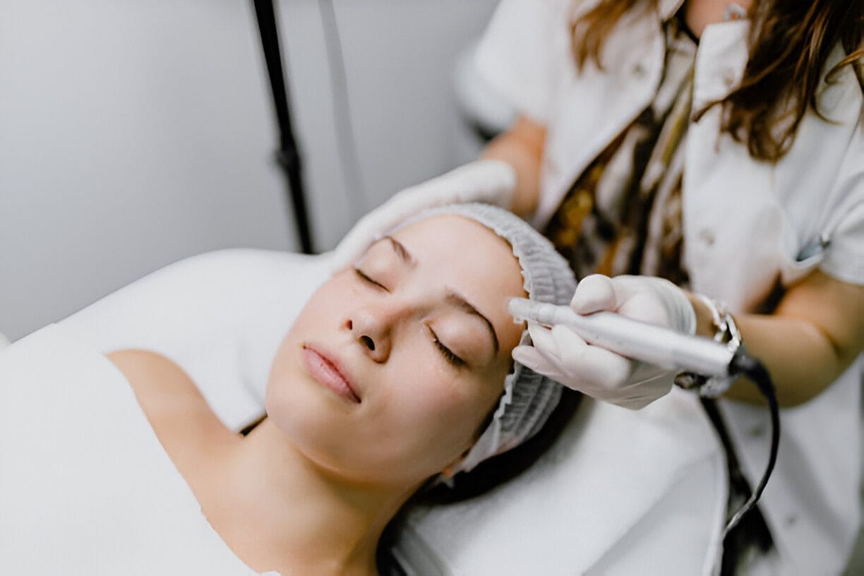 chemical peel treatment Kelowna