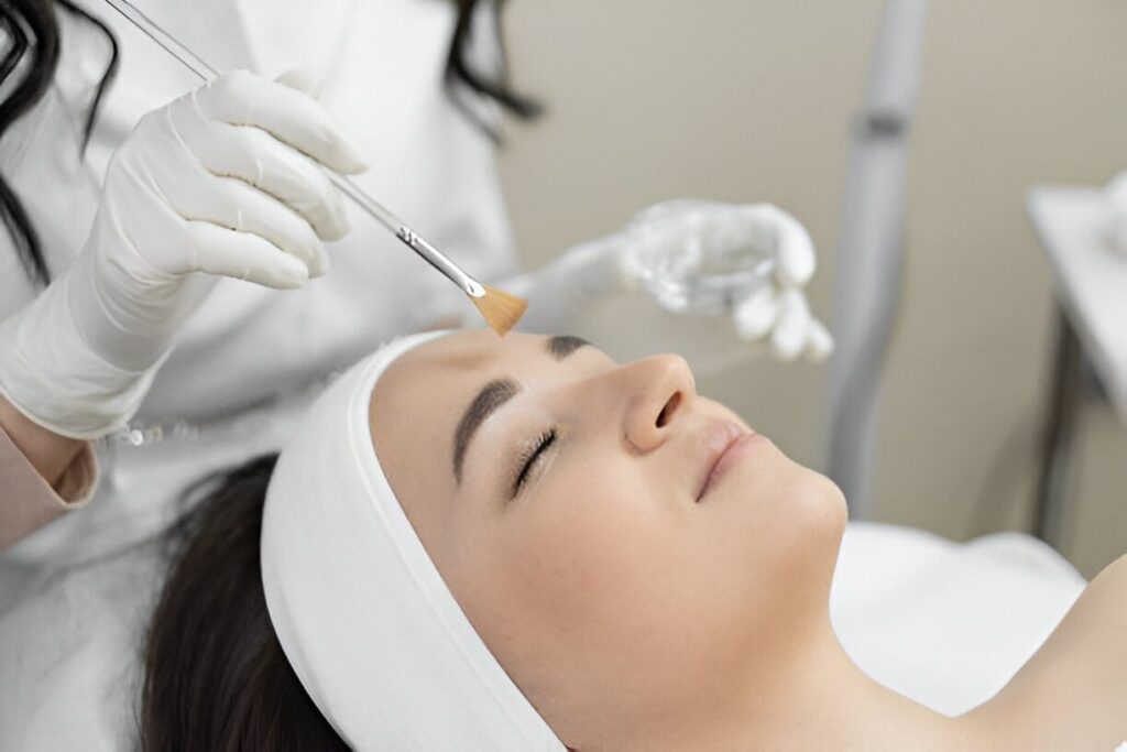 microneedling treatment in Kelowna