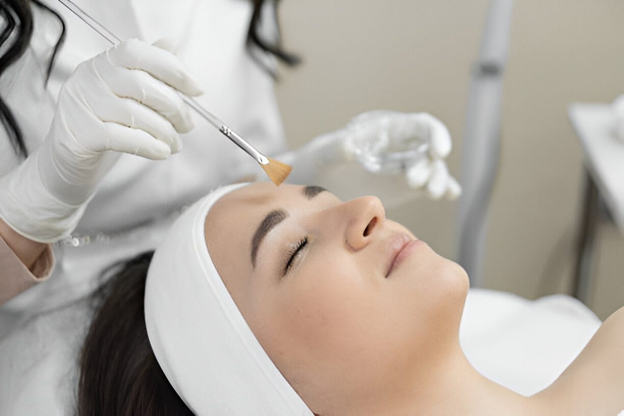 microneedling treatment in Kelowna