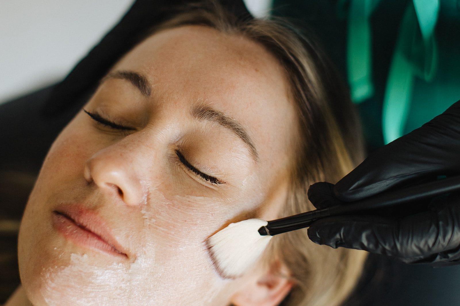 preparing for botox treatment in Kelowna preparing for botox treatment in Kelowna