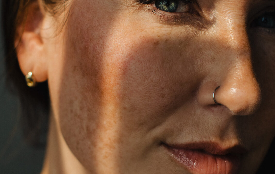 Beyond UV: Why Your Sunscreen Should Also Block Visible Light